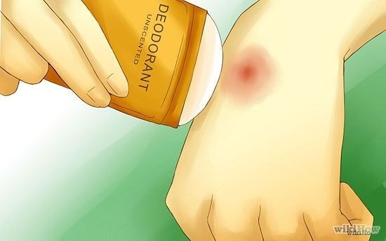 Camping hacks - deodorant for mozzie bites